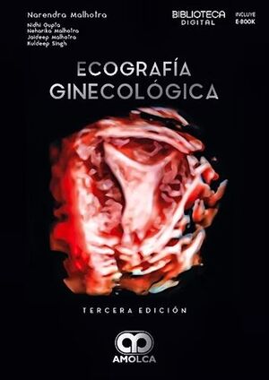 ECOGRAFÍA GINECOLÓGICA