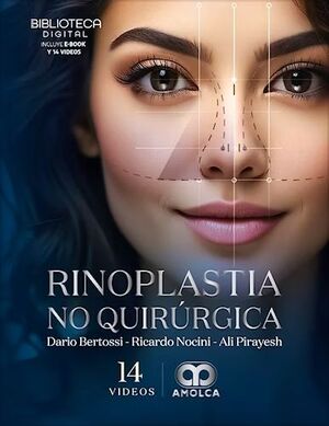 RINOPLASTIA NO QUIRÚRGICA